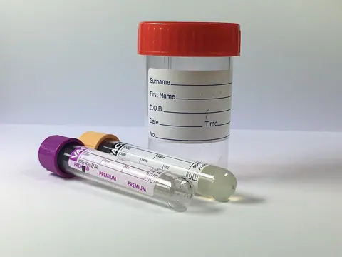 Medical sample containers and collection tubes.
