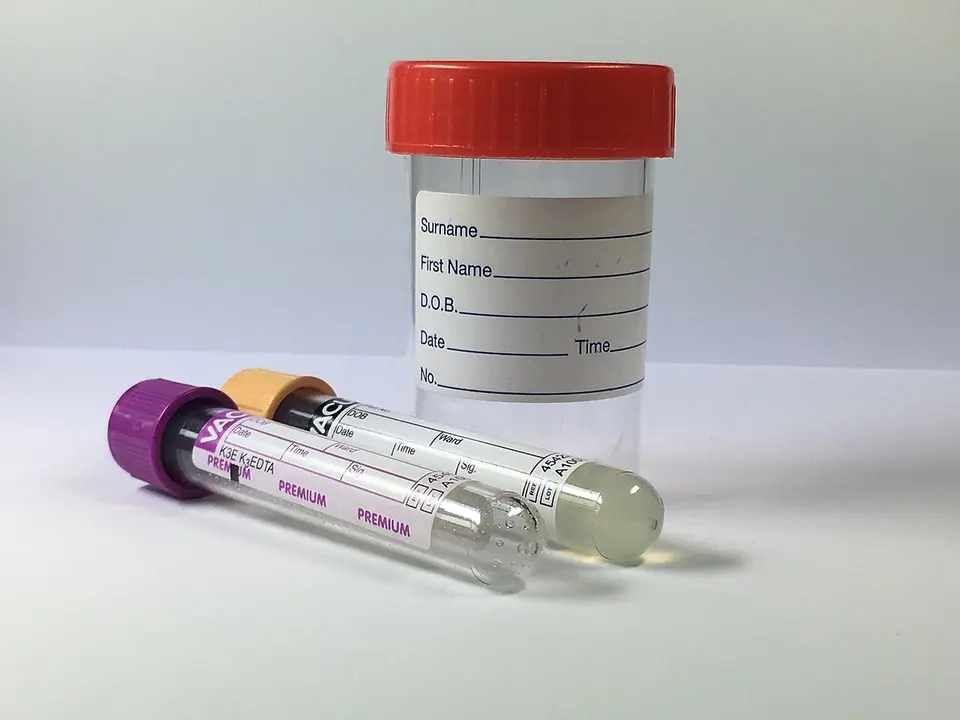 Medical sample containers and collection tubes.
